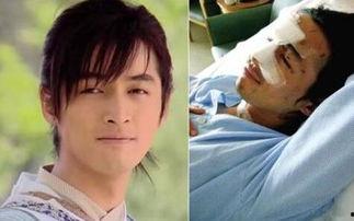 胡歌车祸前后照片对比,重生之路见证坚韧与蜕变